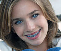 smiling girl with braces